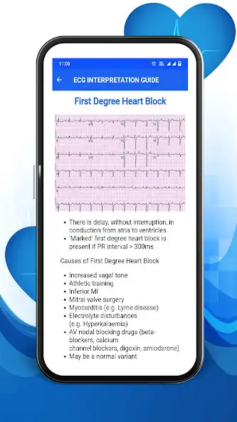 Play ECG Guide by SoftSolutions as an online game ECG Guide by SoftSolutions with UptoPlay