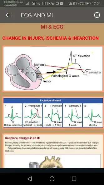Play ECG Interpretation Part 2 as an online game ECG Interpretation Part 2 with UptoPlay