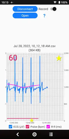 Play ECG Logger for Polar H10  and enjoy ECG Logger for Polar H10 with UptoPlay