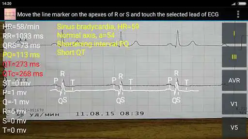 Play ECG Reader 2 free as an online game online ECG Reader 2 free with UptoPlay b4a.ecgread Play ECG Reader 2 free as an online game ECG Reader 2 free with UptoPlay