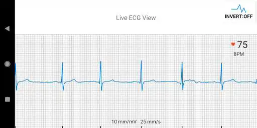 Play ECG Research App as an online game ECG Research App with UptoPlay