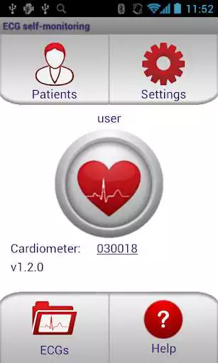 Play ECG Self-monitoring