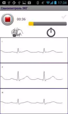 Play ECG Self-monitoring