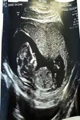 Play Echography