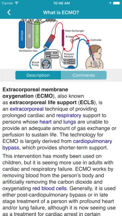 Play ECMO as an online game ECMO with UptoPlay
