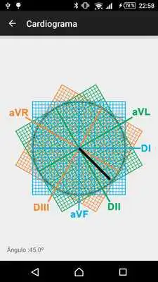 Play Eixo Cardiograma Play Eixo Cardiograma