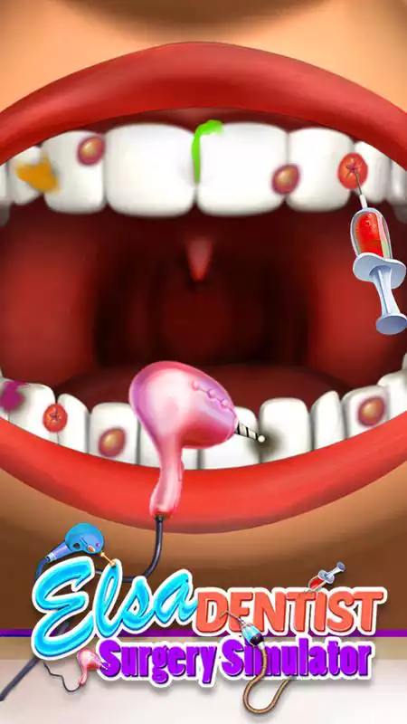 Play Elsa Dentist Surgery Simulator