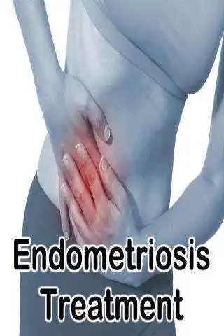 Play Endometriosis Treatment Play Endometriosis Treatment