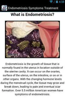 Play Endometriosis Treatment Play Endometriosis Treatment