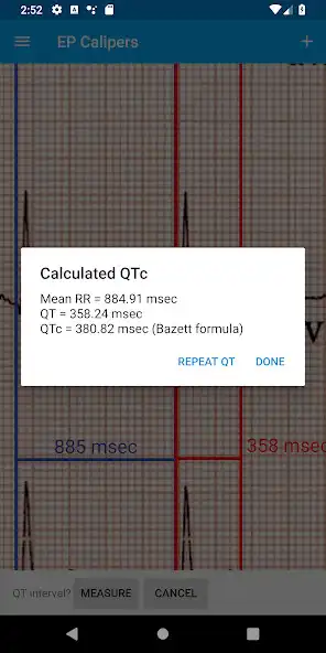 Play EP Calipers  and enjoy EP Calipers with UptoPlay