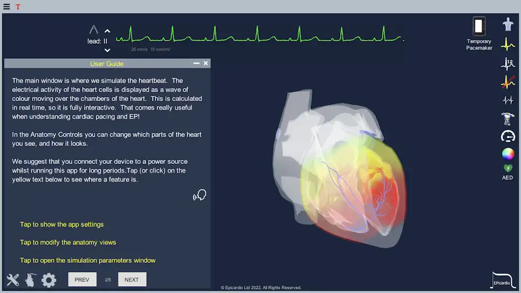 Play Epicardio Heart Simulator as an online game Epicardio Heart Simulator with UptoPlay