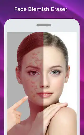 Play Face Blemish Eraser makeup  and enjoy Face Blemish Eraser makeup with UptoPlay