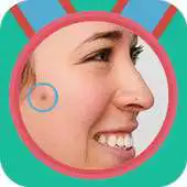 Free play online Face Blemishes APK