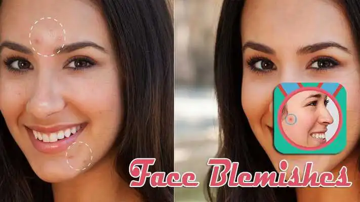 Play Face Blemishes