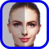 Free play online Face Blemish APK