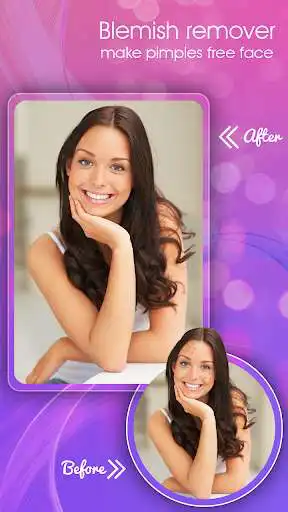 Play Face Blemish Remover 2018 - Beautify Face Makeup  and enjoy Face Blemish Remover 2018 - Beautify Face Makeup with UptoPlay