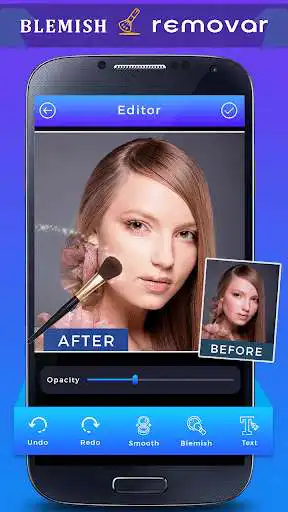 Play Face Blemish Remover - Remove Pimple  and enjoy Face Blemish Remover - Remove Pimple with UptoPlay