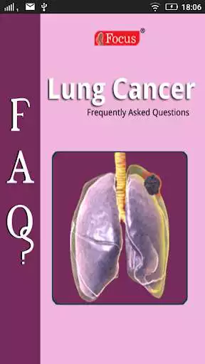 Play FAQs in Lung Cancer  and enjoy FAQs in Lung Cancer with UptoPlay