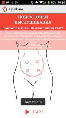 Play FetalCare