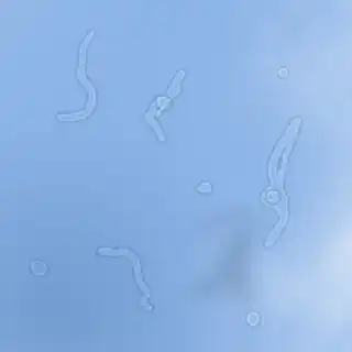 Play Floaters In The Eye  and enjoy Floaters In The Eye with UptoPlay