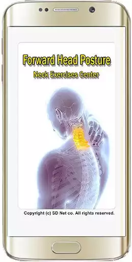 Play Forward Head Posture (FHP)