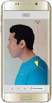 Play Forward Head Posture (FHP)