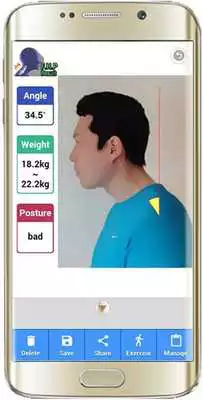 Play Forward Head Posture (FHP)