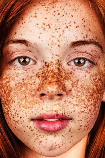 Play freckles tips  and enjoy freckles tips with UptoPlay