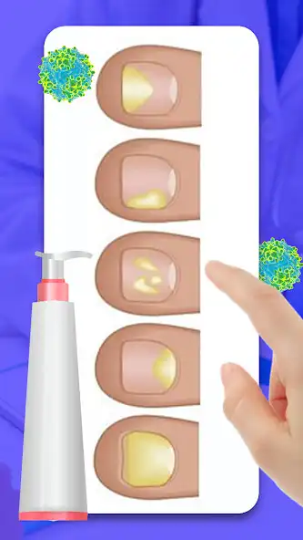 Play Fungal skin diseases as an online game Fungal skin diseases with UptoPlay