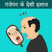 Free play online GanjePan k ilaj - Hair Loss APK Free play online GanjePan k ilaj - Hair Loss APK