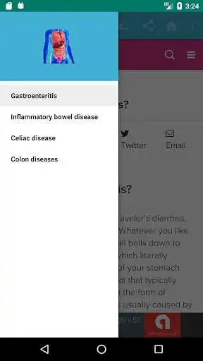 Play Gastrointestinal system diseases anatomy as an online game online Gastrointestinal system diseases anatomy with UptoPlay com.Gastrointestinal.diseases Play Gastrointestinal system diseases anatomy as an online game Gastrointestinal system diseases anatomy with UptoPlay