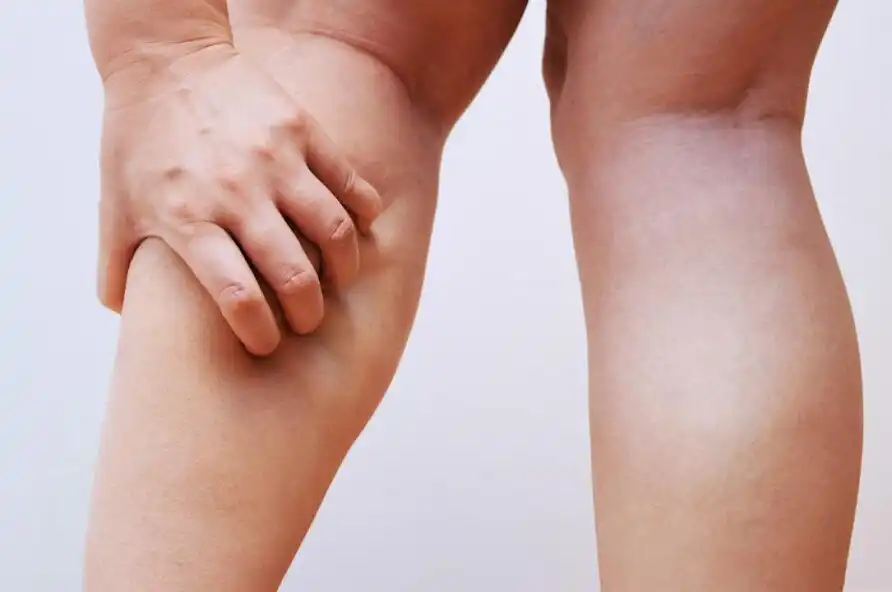 Play Get Rid of Legs Cramps  and enjoy Get Rid of Legs Cramps with UptoPlay