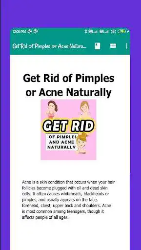 Play Get Rid of Pimples or Acne Naturally as an online game online Get Rid of Pimples or Acne Naturally with UptoPlay com.HyperBrinz.GeRiPimpAcnNatur Play Get Rid of Pimples or Acne Naturally as an online game Get Rid of Pimples or Acne Naturally with UptoPlay
