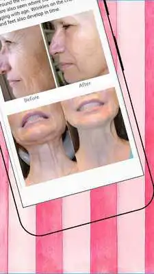 Play Get Rid Of Wrinkles Naturally - Skin and Face Care