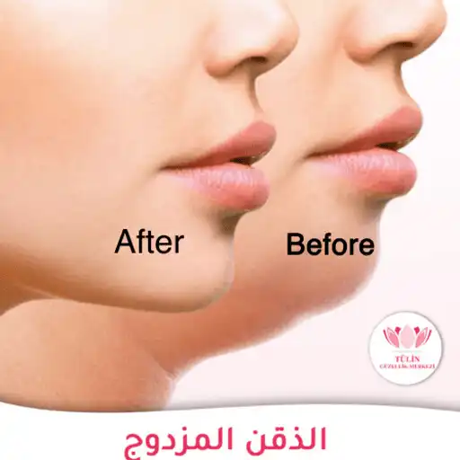 Play Getting rid of double chin APK