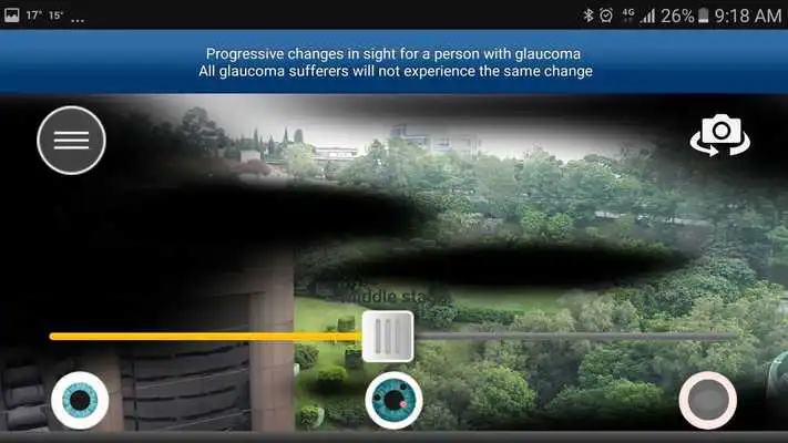 Play Glaucoma App