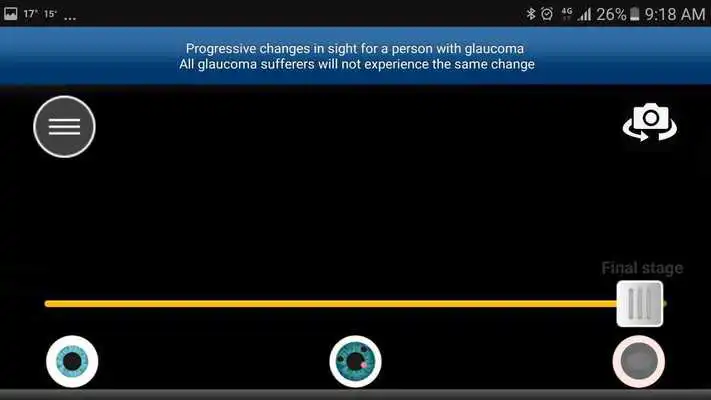 Play Glaucoma App