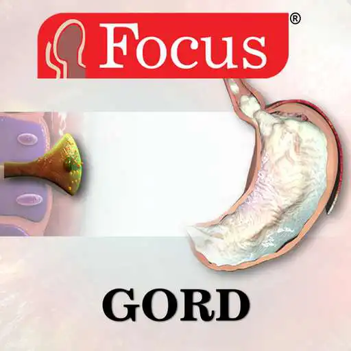 Play GORD APK
