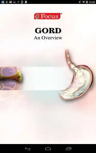 Play GORD and enjoy GORD with UptoPlay Play GORD and enjoy GORD with UptoPlay