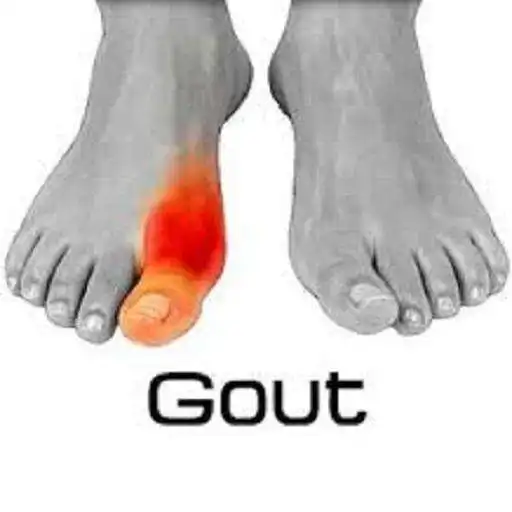 Free play online Gout Disease APK