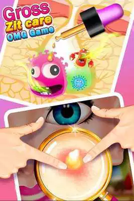 Play Gross Zit Care - OMG Game Play Gross Zit Care - OMG Game