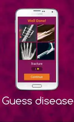 Play Guess disease