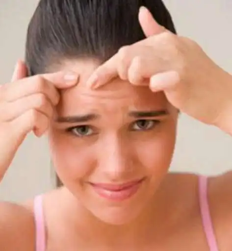 Play guide to Get rid of Acne  and enjoy guide to Get rid of Acne with UptoPlay