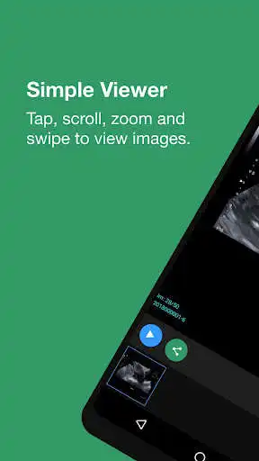 Play Hamilton MyImages as an online game online Hamilton MyImages with UptoPlay com.zedtechnologies.hamrad.patient.droid Play Hamilton MyImages as an online game Hamilton MyImages with UptoPlay