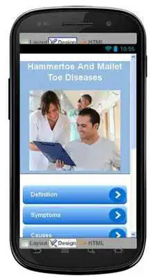Play Hammertoe And Mallet Toe