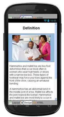 Play Hammertoe And Mallet Toe