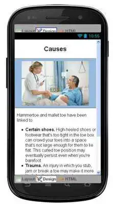 Play Hammertoe And Mallet Toe