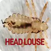 Free play online Head Louse APK