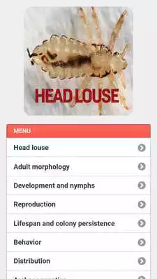 Play Head Louse Play Head Louse