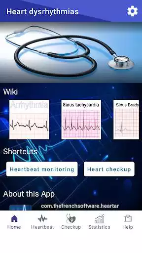 Play Heart dysrhythmias  and enjoy Heart dysrhythmias with UptoPlay